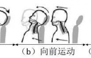 汽车鞭打试验-追尾碰撞中乘员颈部保护评价方法简介